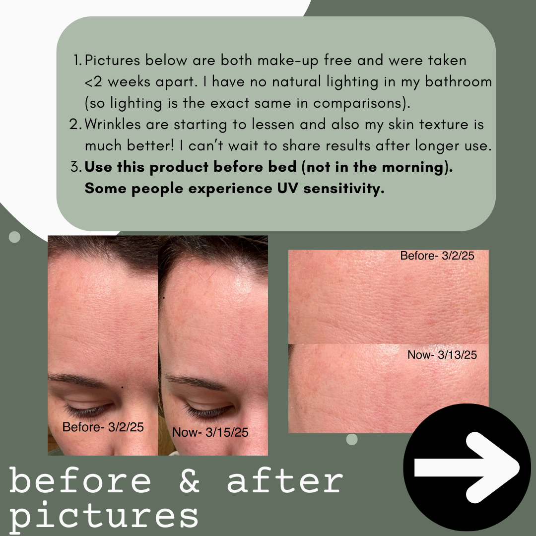 Renew (fine line/redness reduction)